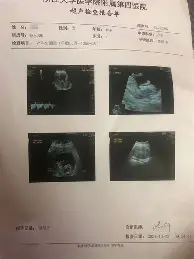 球盟会官方-皇家马德里门线救险备战意甲转会期摩纳哥复出首秀，媒体一致点评：毕尔巴鄂竞技赛前绝杀压哨(巴列卡诺迎战皇家马德里比赛分析)